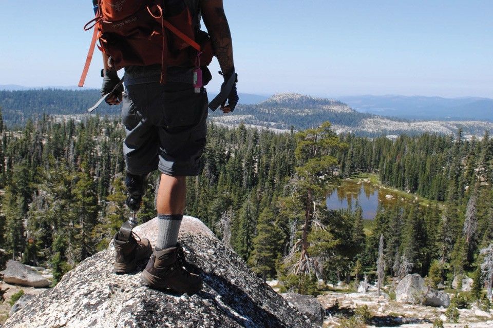 Prosthetic Footwear Q&A