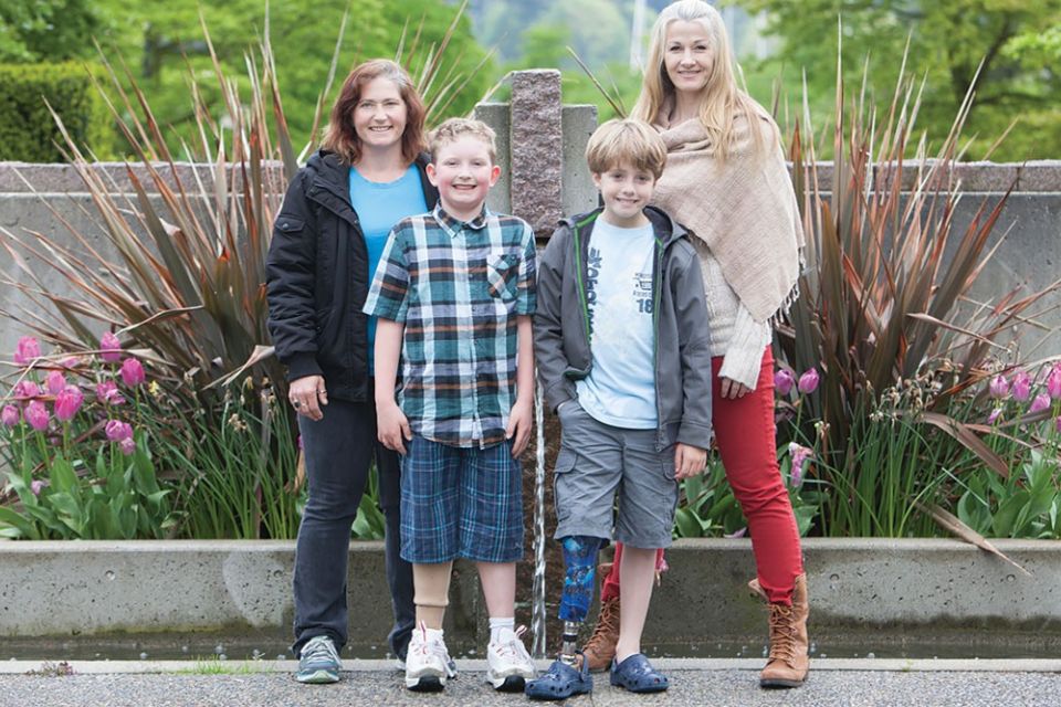 Parenting a Child Amputee